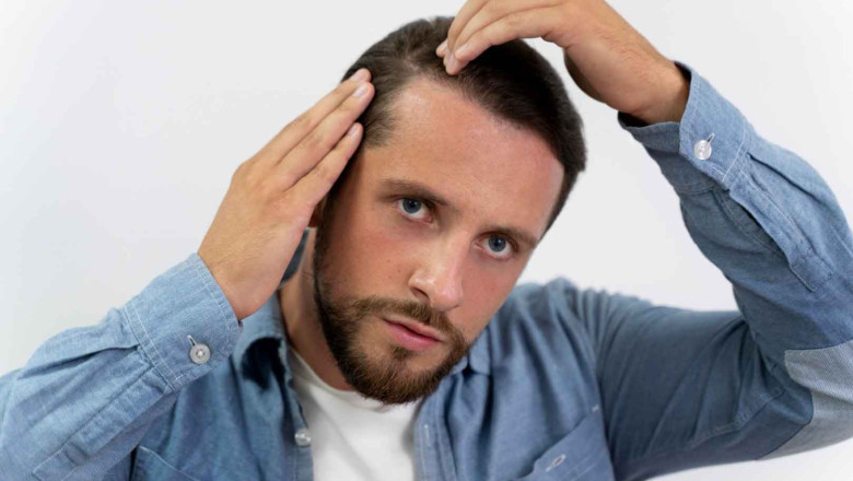 clinica trasplante capilar sevilla 