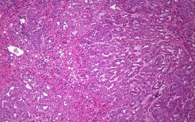 ep celulas hepaticas