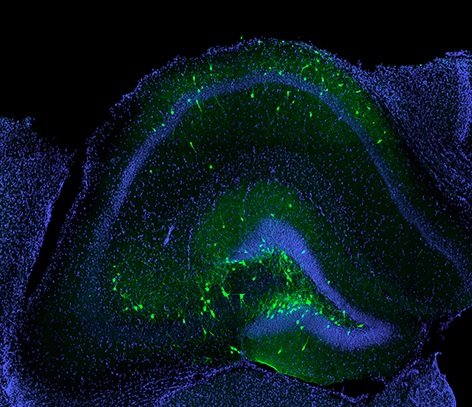ep neuronas inhibidoras trasplantadas verdes incorporadas con exito en el hipocampo de un raton con