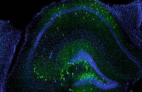 ep neuronas inhibidoras trasplantadas verdes incorporadas con exito en el hipocampo de un raton con