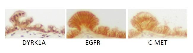 ep estudiouna proteina relacionadacancerpancreas