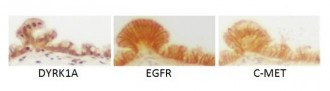 ep estudiouna proteina relacionadacancerpancreas