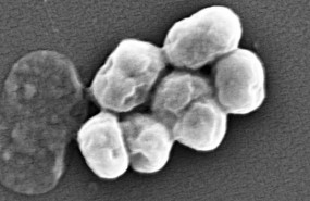 ep imagen de a baumannii visualizada por microscopia electronica
