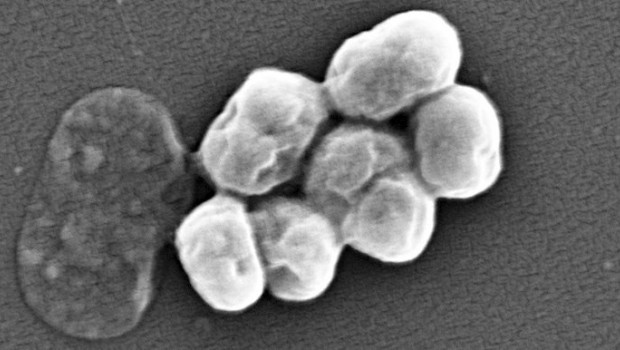 ep imagen de a baumannii visualizada por microscopia electronica