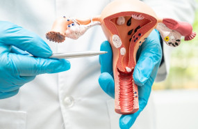 cancer ginecologico en tamano grande cancer ginecologico en tamano grande