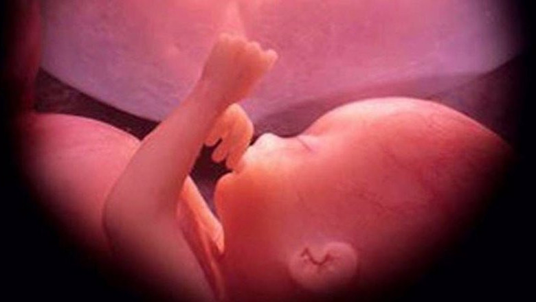 Archivo - BEBE | TWITTER - Archivo ep archivo bebe