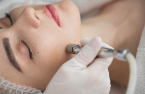 1655967325 microdermoabrasi n con punta de diamante 1655967325 microdermoabrasi n con punta de diamante