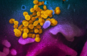 ep imagen de microscopio electronico de barrido muestra sars-cov-2 amarillo tambien conocido como