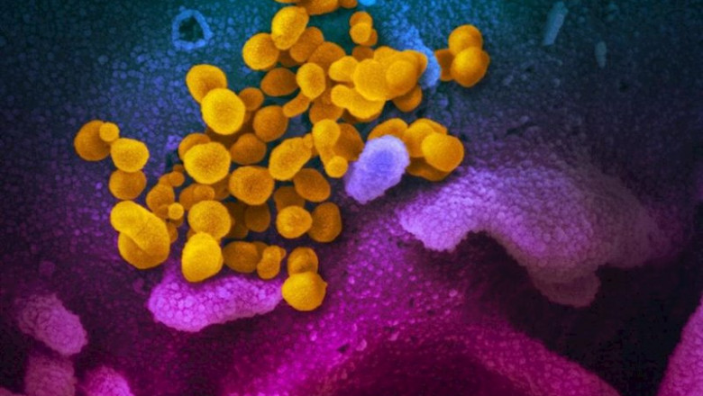 Imagen De Microscopio Electrónico De Barrido Muestra SARS-Cov-2 (Amarillo), También Conocido Como 2019-Ncov, El Virus Que Causa COVID-19, Aislado De Un Paciente En Los EE. UU. ) Cultivados En El Laboratorio. | NIAID RML ep imagen de microscopio electronico de barrido muestra sars-cov-2 amarillo tambien conocido como