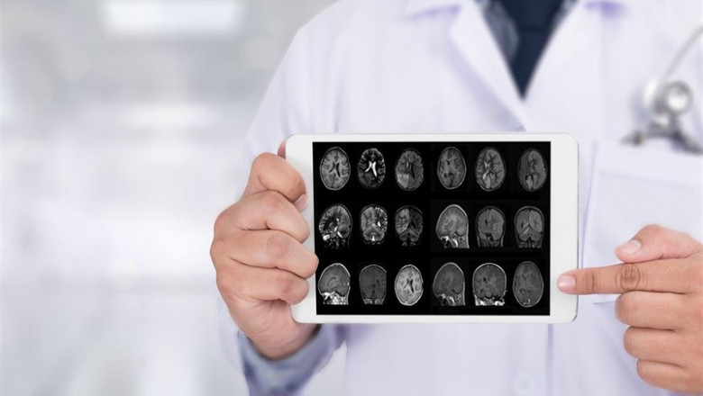ep alzheimer 20190719170502