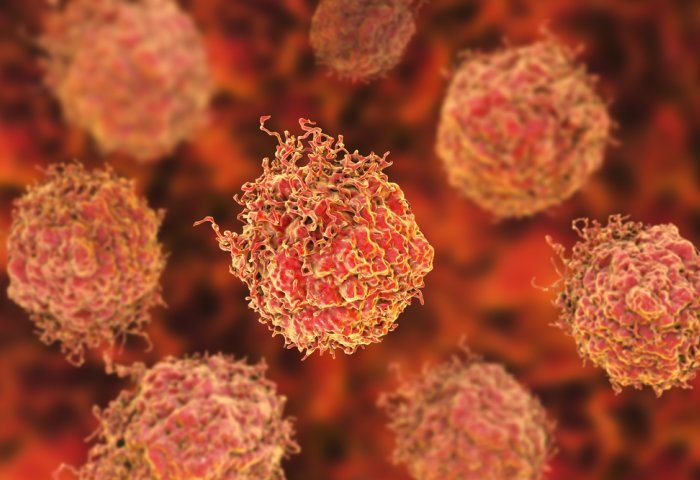 ep celulas en el cancer de prostata 20200306112403