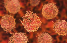 ep celulas en el cancer de prostata 20200306112403