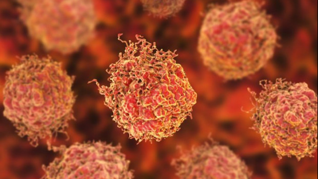 ep celulas en el cancer de prostata 20200306112403