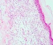 ep nuevo mecanismoregulacion inmune utilizadolos virus