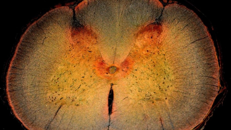 Sección transversal de la médula espinal, incluido el cuerno dorsal de la médula espinal, donde se procesa el dolor. | DW_ROSS / FLICKR ep seccion transversalla medula espinal incluidocuerno dorsalla medula espinal dondeprocesadolor