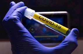 ep coronavirus 20200601172402 ep coronavirus 20200601172402
