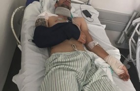 ep herido