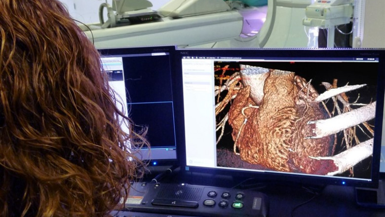 Tomografía computarizada (TAC) | GE HEALTHCARE - Archivo ep tomografia computarizada tac