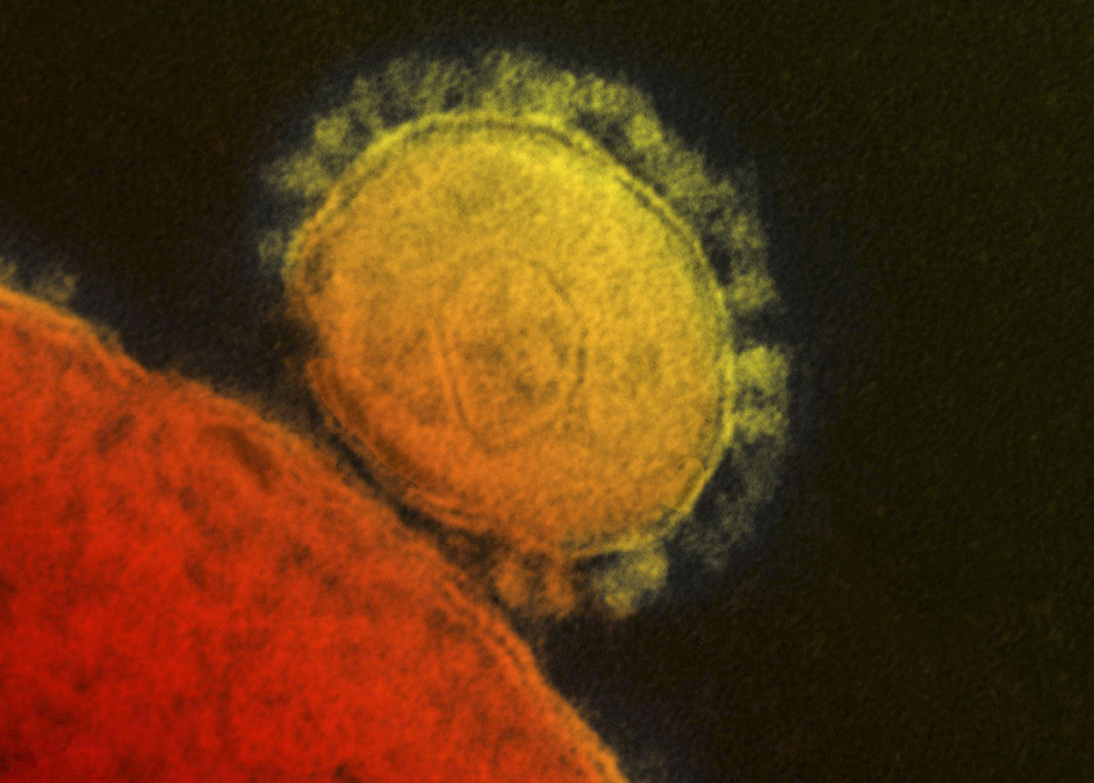 coronavirus