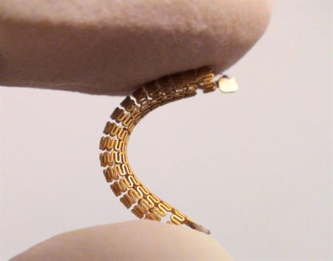 ep stent inteligente