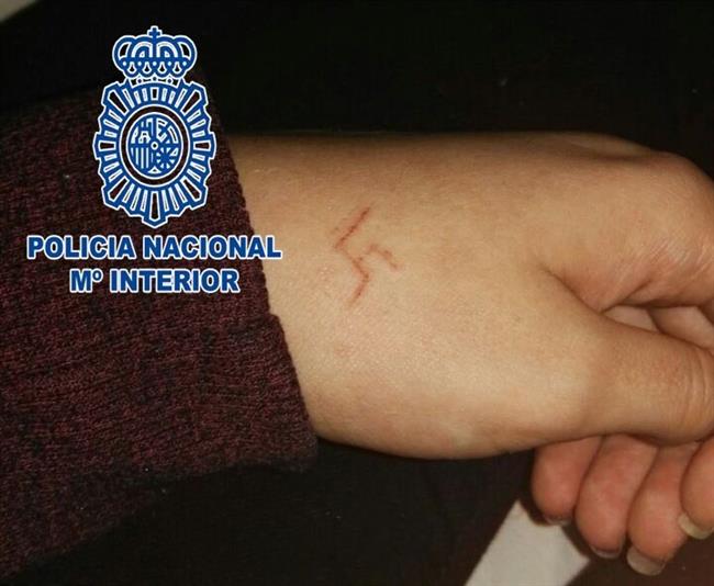 Herida | JEFATURA SUPERIOR DE POLICÍA DE MADRID ep herida
