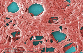 ep bacteria legionella