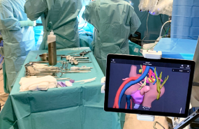 modelo 3d en quirfano modelo 3d en quirfano