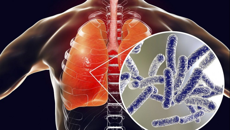 1587975933 rentokil initial