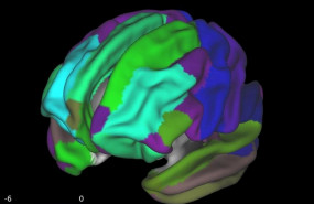 ep el color cian es la corteza prefrontal mientras que toda la corteza mostro adelgazamiento entre