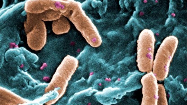 ep bacterias pseudomonas aeruginosa