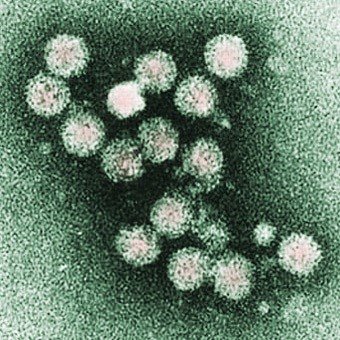 ep virus de la hepatitis c