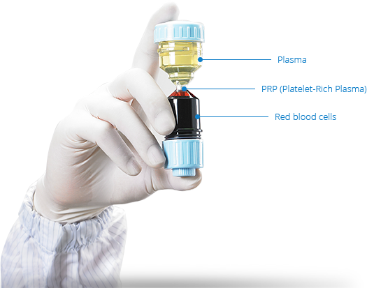 1570530520 prp description copia