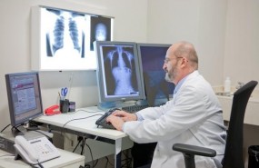 ep avancescancerpulmon