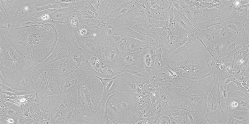 Células epiteliales del timo derivadas de células iPS, visualizadas por microscopía de contraste de fase. | HOKKAIDO UNIVERSITY ep celulas epiteliales del timo derivadas de celulas ips visualizadas por microscopia de contraste
