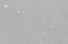 ep celulas epiteliales del timo derivadas de celulas ips visualizadas por microscopia de contraste