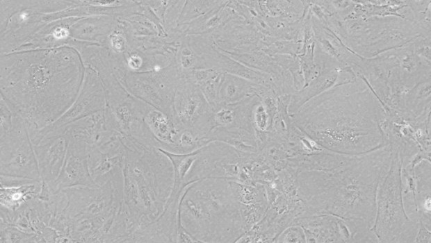 ep celulas epiteliales del timo derivadas de celulas ips visualizadas por microscopia de contraste