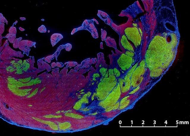Consiguen restaurar la función cardíaca en monos con células madre humanas | XIULAN YANG/MURRY LAB ep consiguen restaurarfuncion cardiacamonoscelulas madre humanas