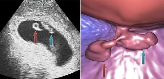 Investigadores desarrollan técnica ecografías virtuales embrios implantados | UGR Y CLÍNICA MARGEN ep investigadores desarrollan tecnica ecografias virtuales embrios implantados