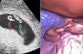 ep investigadores desarrollan tecnica ecografias virtuales embrios implantados