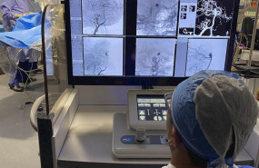 ep el doctor vitor mendes pereira ve las imagenes de la colocacion de un stent a control remoto para