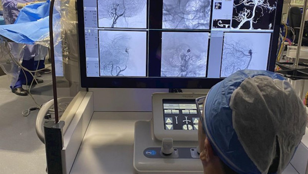 ep el doctor vitor mendes pereira ve las imagenes de la colocacion de un stent a control remoto para