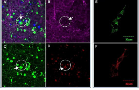 ep en el cerebro de ratones con alzheimer aparecen areas cercanas a las placas amiloides a con menos