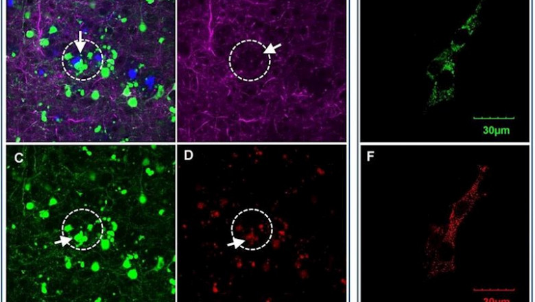 ep en el cerebro de ratones con alzheimer aparecen areas cercanas a las placas amiloides a con menos