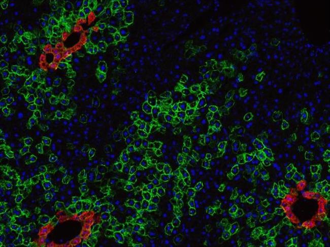 Células madre (en rojo) del hígado de un ratón | LABORATORIO NUSSE/HHMI - Archivo ep celulas madre en rojo del higadoun raton