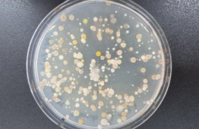 ep placa de petri con cultivos de bacterias que han crecido en los sedimentos marinos