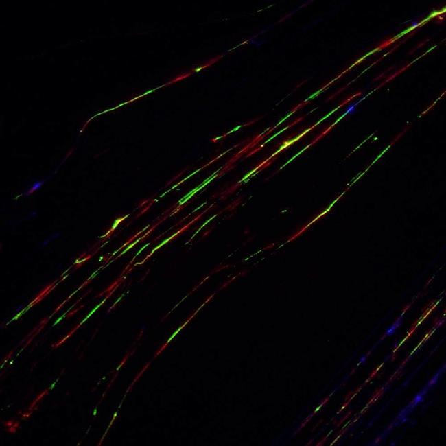 Fibras de ADN marcadas con sondas fluorescentes | CSIC ep fibrasadn marcadassondas fluorescentes