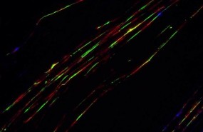 ep fibrasadn marcadassondas fluorescentes