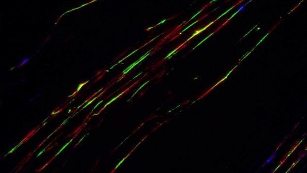 ep fibrasadn marcadassondas fluorescentes