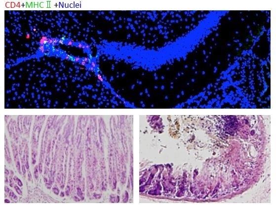 Microinflamación en zonas específicas del cerebro | HOKKAIDO UNIVERSITY ep microinflamacionzonas especificascerebro
