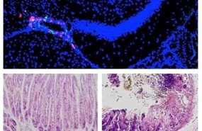ep microinflamacionzonas especificascerebro